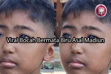 albaniatourism.info Viral Bocah Bermata Biru Asal Madiun