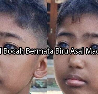 albaniatourism.info Viral Bocah Bermata Biru Asal Madiun