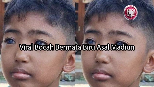 albaniatourism.info Viral Bocah Bermata Biru Asal Madiun